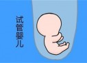 培养天津捐卵宝宝艺术细胞的小技巧